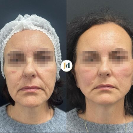 WhatsApp Image 2025-12-15 at 13.51.56